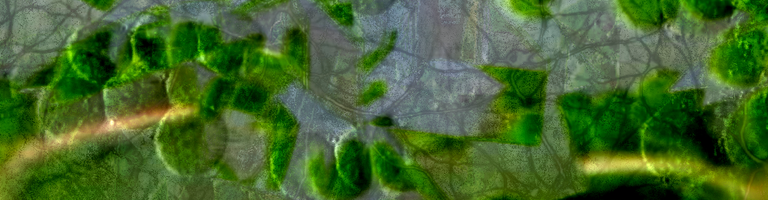 Twin Peetz cover image
